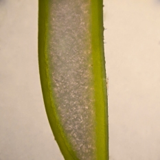 Cross-section of the blade of a serrated wrack (Fucus serratus)